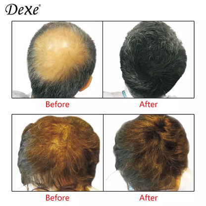 Dexe增髮纖維粉(黑）